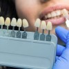 審美歯科治療で歯科医師が歯の色合いを確認